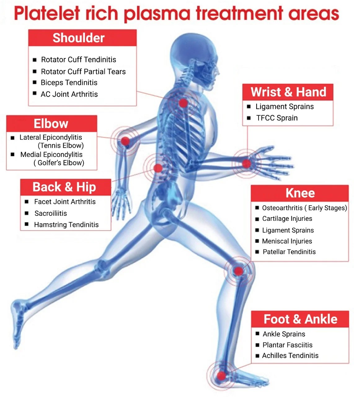 PRP INJECTIONS IN ORTHOPEDICS Dr Naveen Reddy