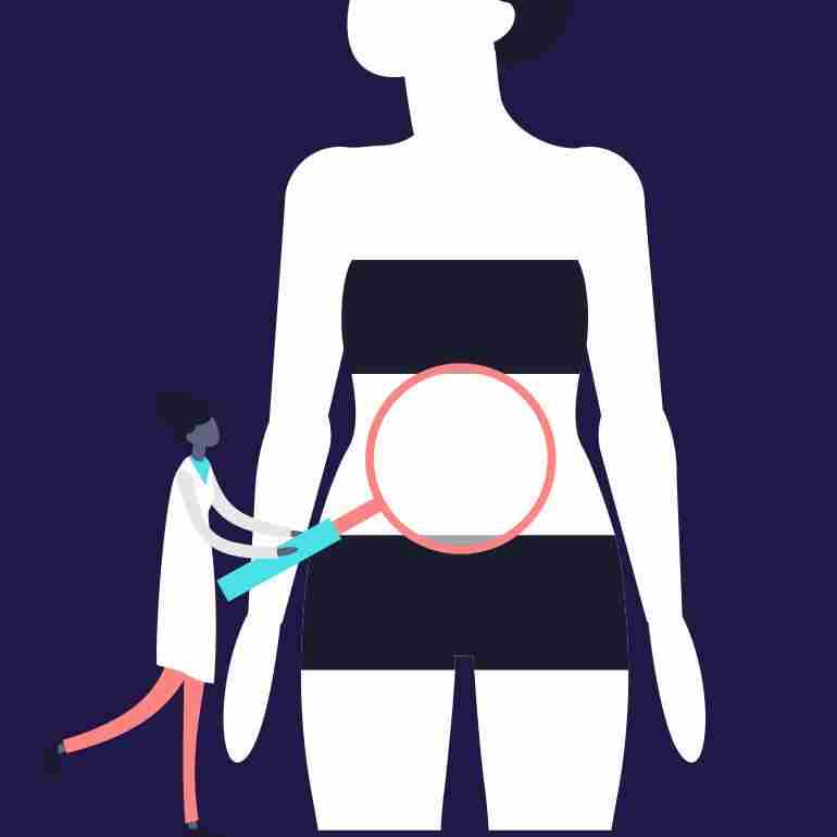 Bikini Line Sleeve Gastrectomy Dr Osama Khalil