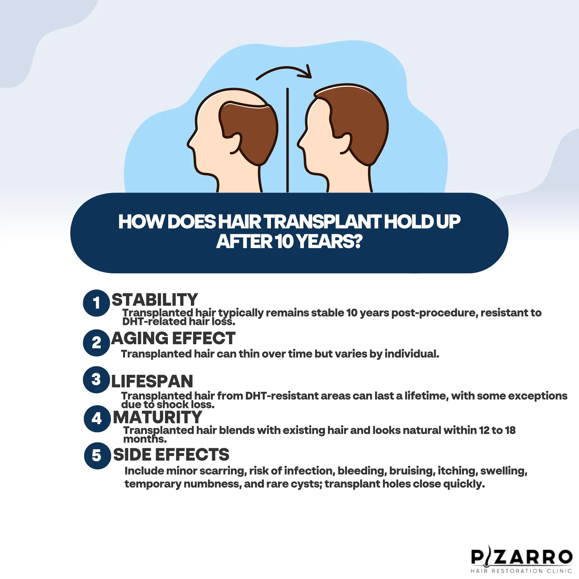 How Does Hair Transplant Hold Up After 10 Years PHR