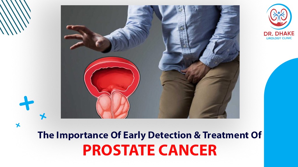 The Importance of Early Detection and Treatment of Prostate Cancer Dr