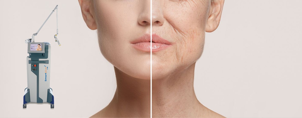 Dr. Sadana's Skin and LASER Centre LASER for skin surgery in Patiala