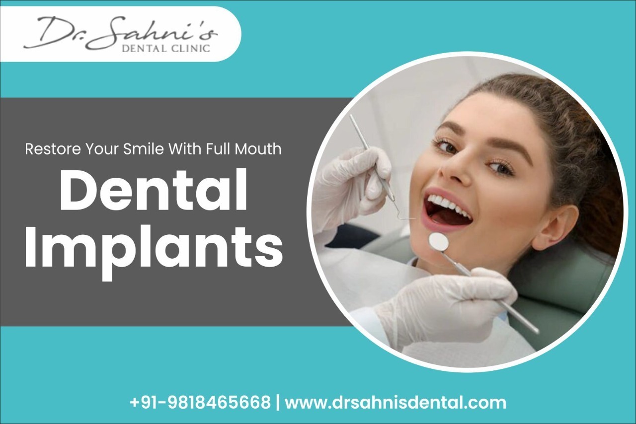 Full mouth dental implants Procedure Cost