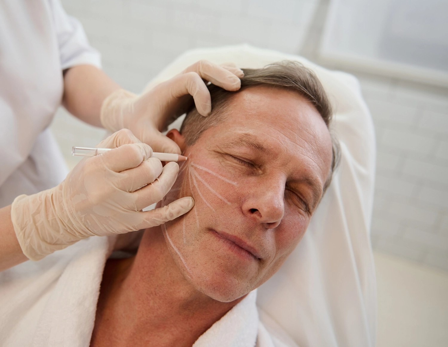 PDO Thread Lift Perth NonSurgical Facelift Everything Skin By Dr Salon