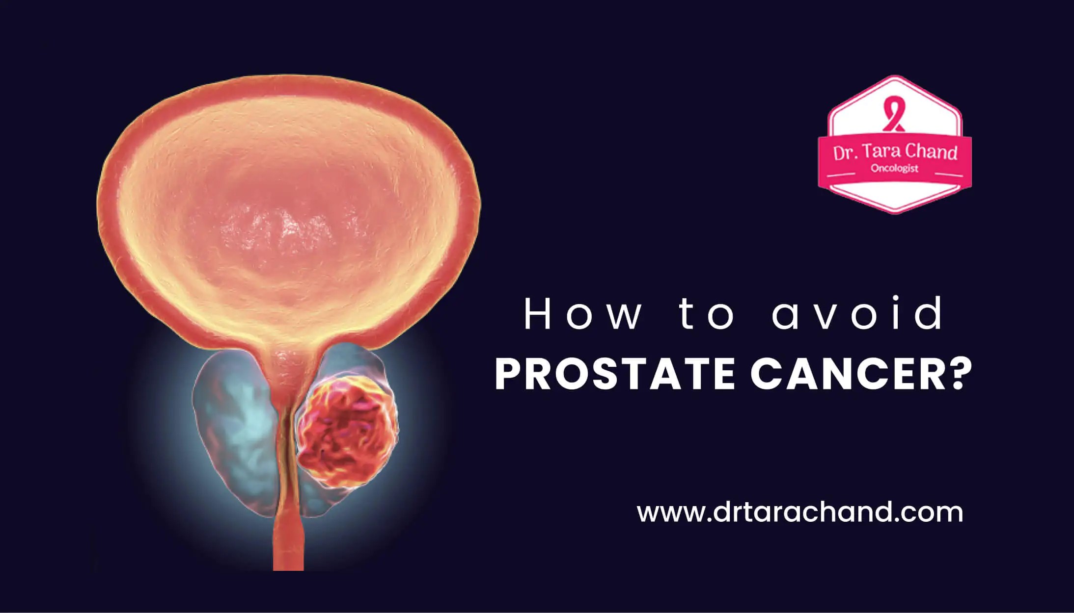 How to avoid prostate cancer? Dr. Tarachand