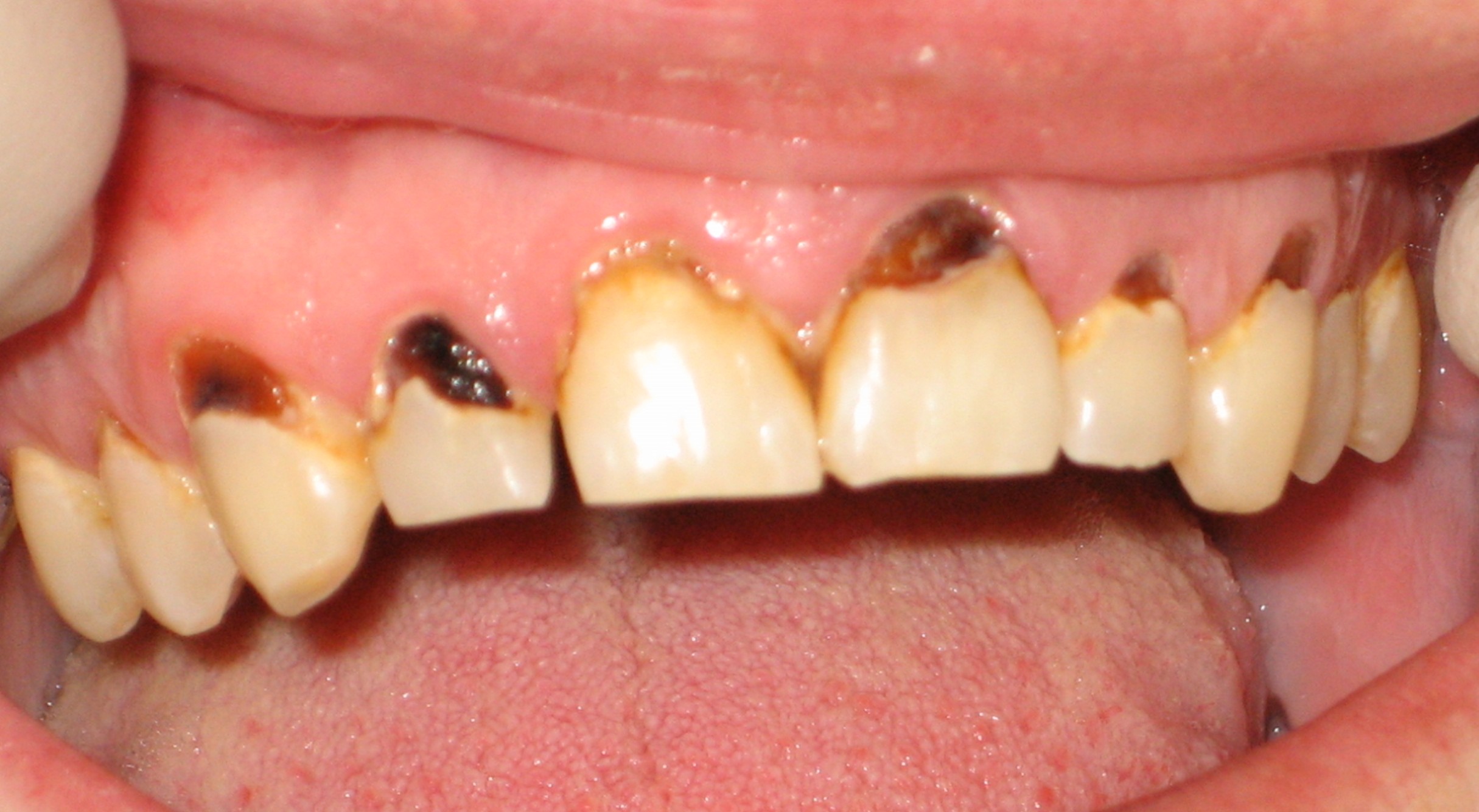 Examples of work before and after Dr James Clark III DDS