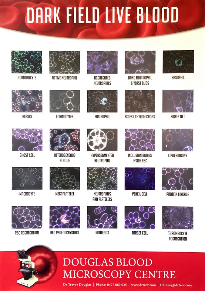 Dark Field Live Blood & Enderlein Posters DOUGLAS BLOOD MICROSCOPY CENTRE