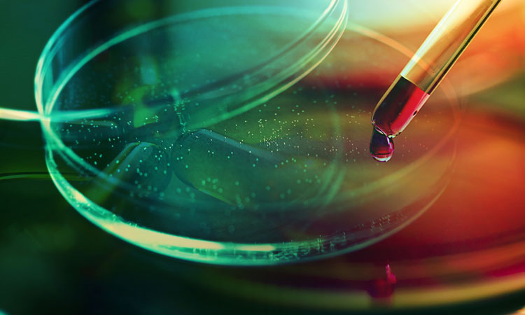 Cell line development biologics development from early phase to IND