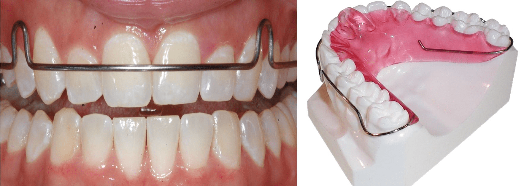 TMJ Disorders Alexandria VA Jaw Pain Treatment