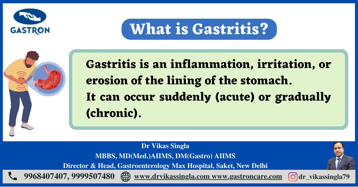 About Gastritis Disease Dr. Vikas Singla