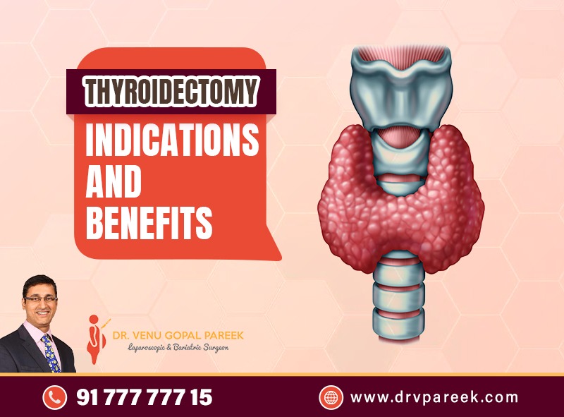 Thyroidectomy Indications and Benefits