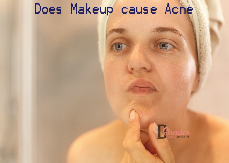 क्या मेकअप लगाने से मुहांसे हो सकते हैं? (Does Makeup cause Acne) Dshadez