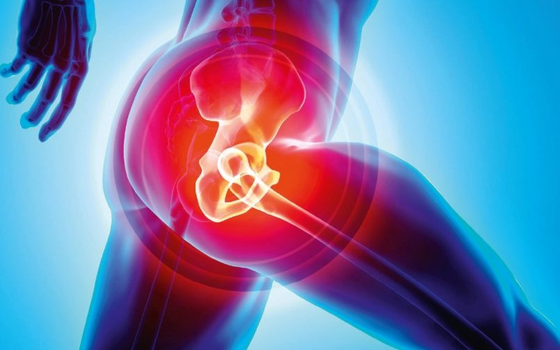 When Do You Need Hip Replacement Surgery and What is It? Dtek Customs