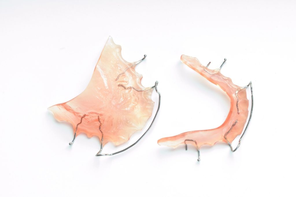 Fixed vs. Removable Orthodontic Appliances Dudley Smiles