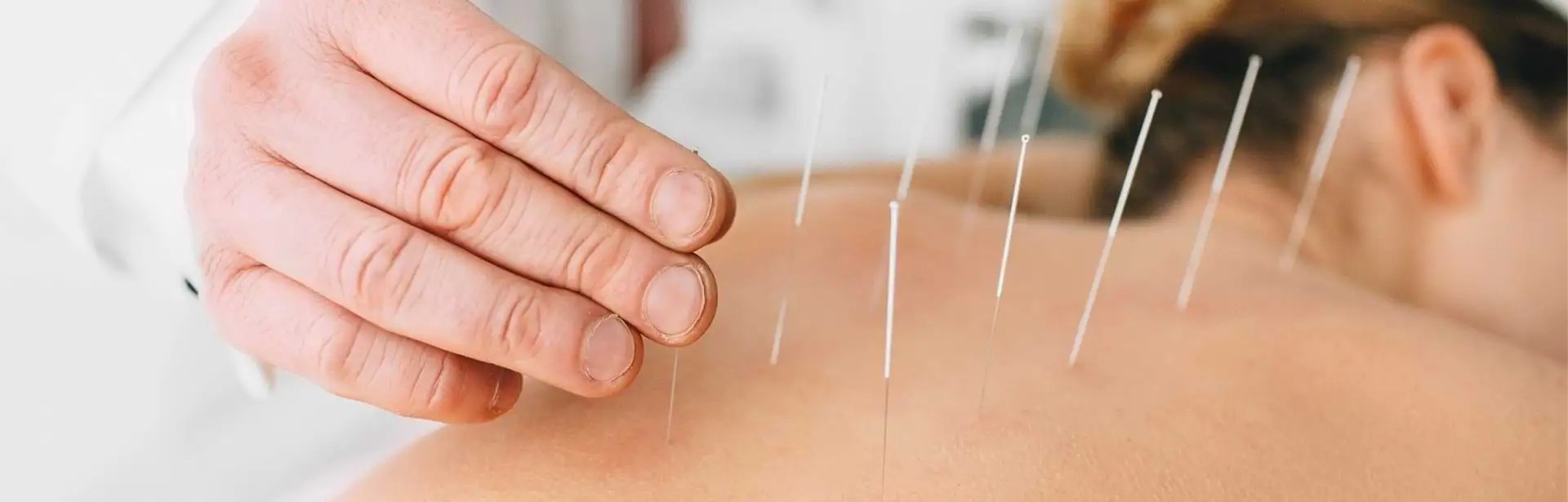 Acupuncture Services Clinic in Downtown Toronto Dundas University