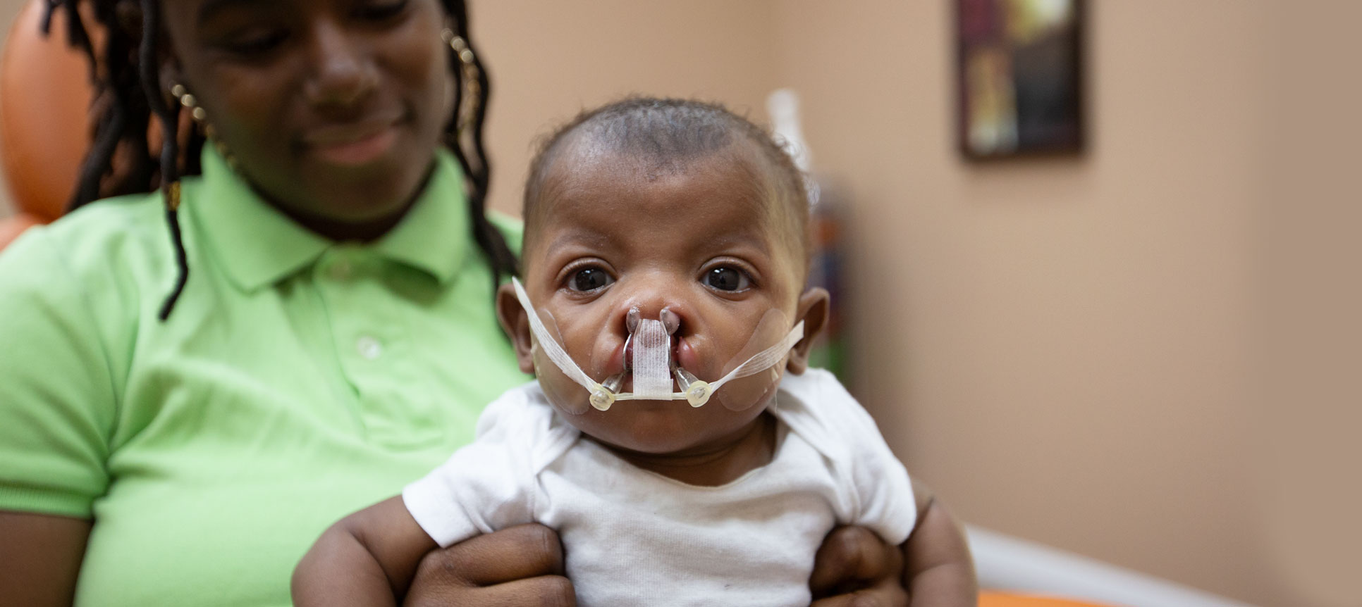 NAM Device Corrects Cleft Lip and Palate with Fewer Surgeries