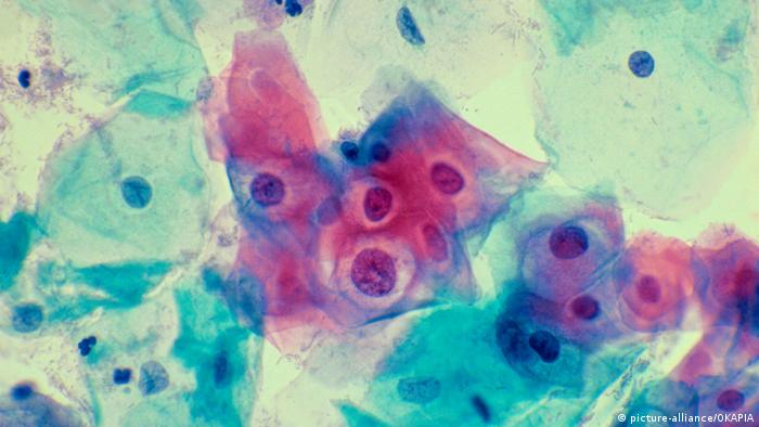 Tried and true HPV vaccination shows sharp drop in cancercausing