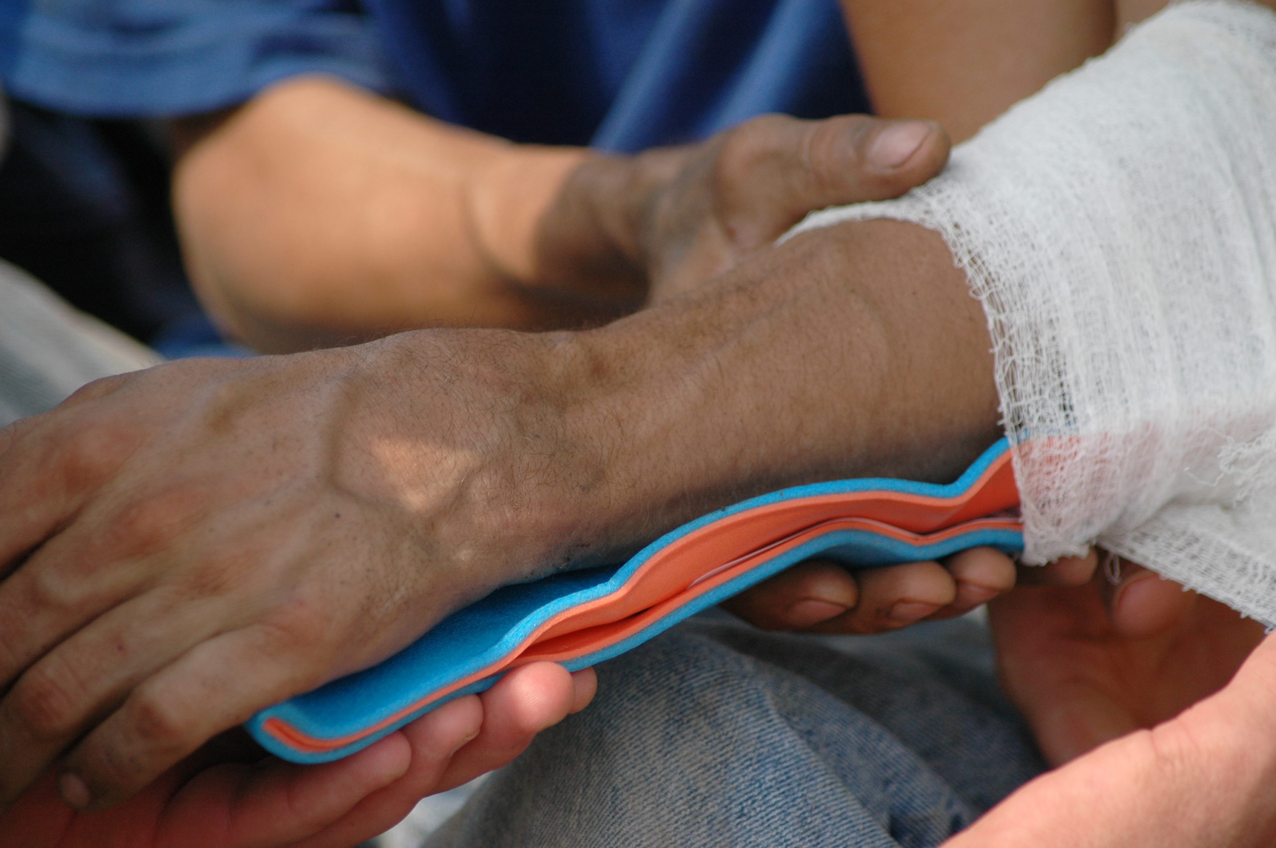 First Aid for a Broken Bone and Fractures eFirstAidSupplies Blog