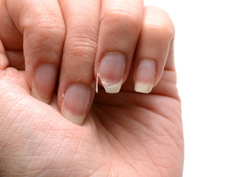 Quelques conseils de traitement des ongles cassants Magazine Santé & Mode & beauté
