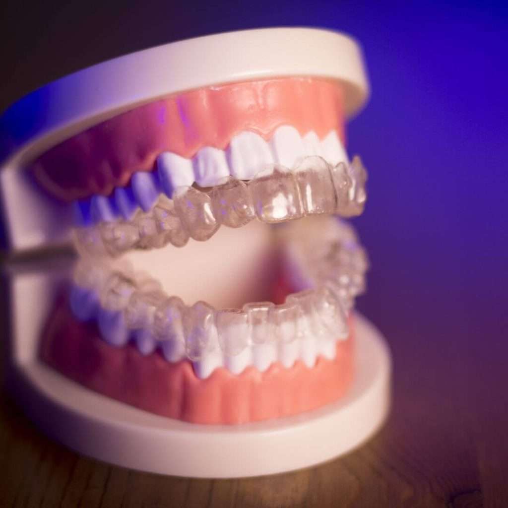 Unleash Your Best Smile with Invisalign The Transparent Solution for
