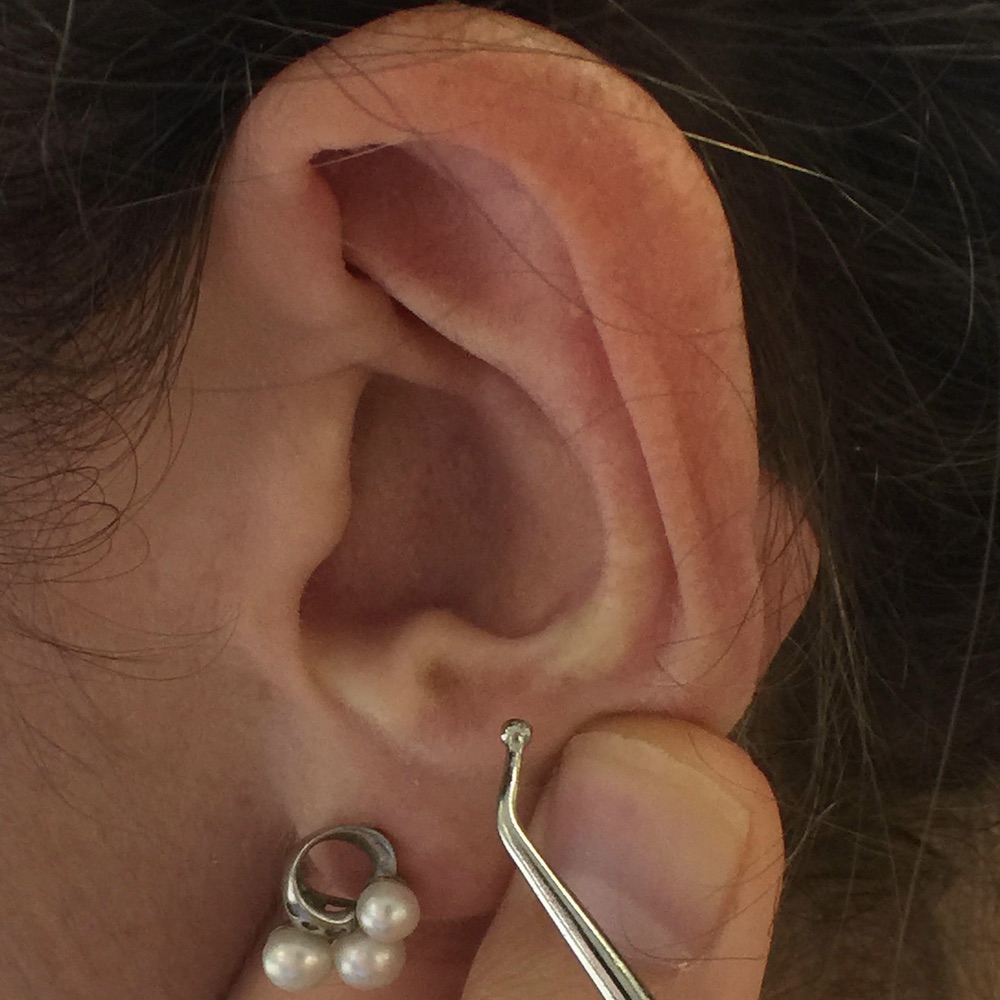 What happens if you put an ear seed on the wrong point? Ear Seeds Products