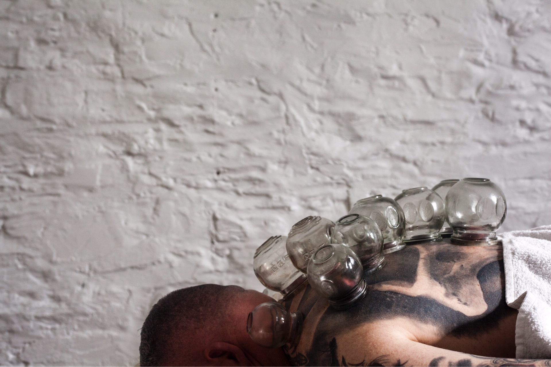 Acupuncture Adelaide East Of West East of West Acupuncture