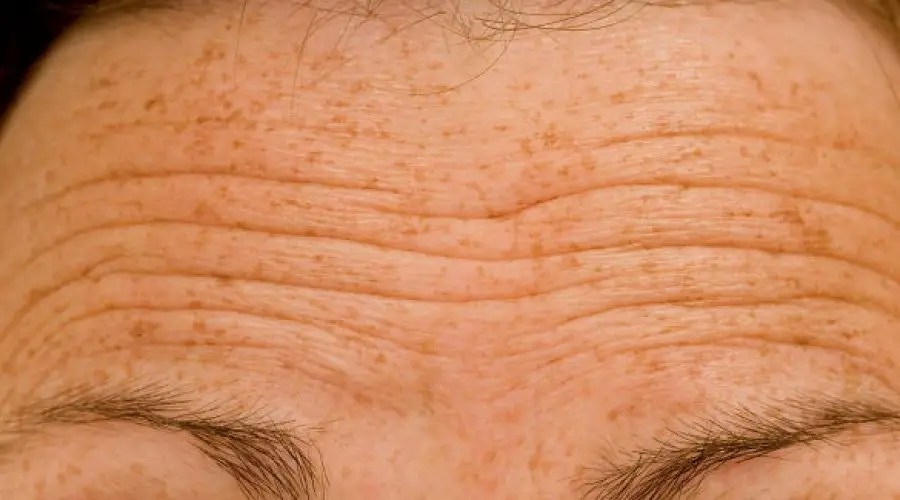 Lines on Forehead Know its Astrological Meaning of Whether they can