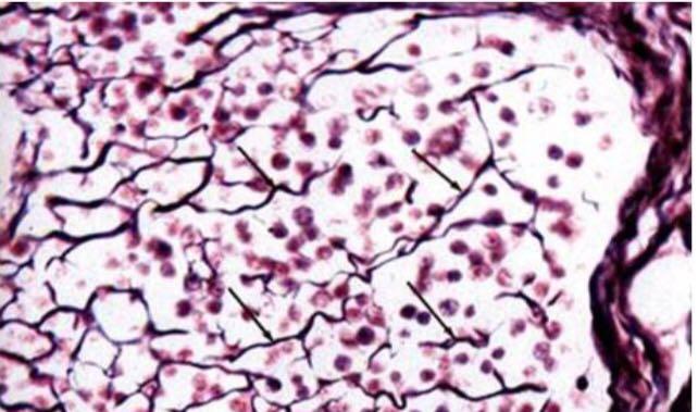 Reticular Connective Tissue Under Microscope Micropedia