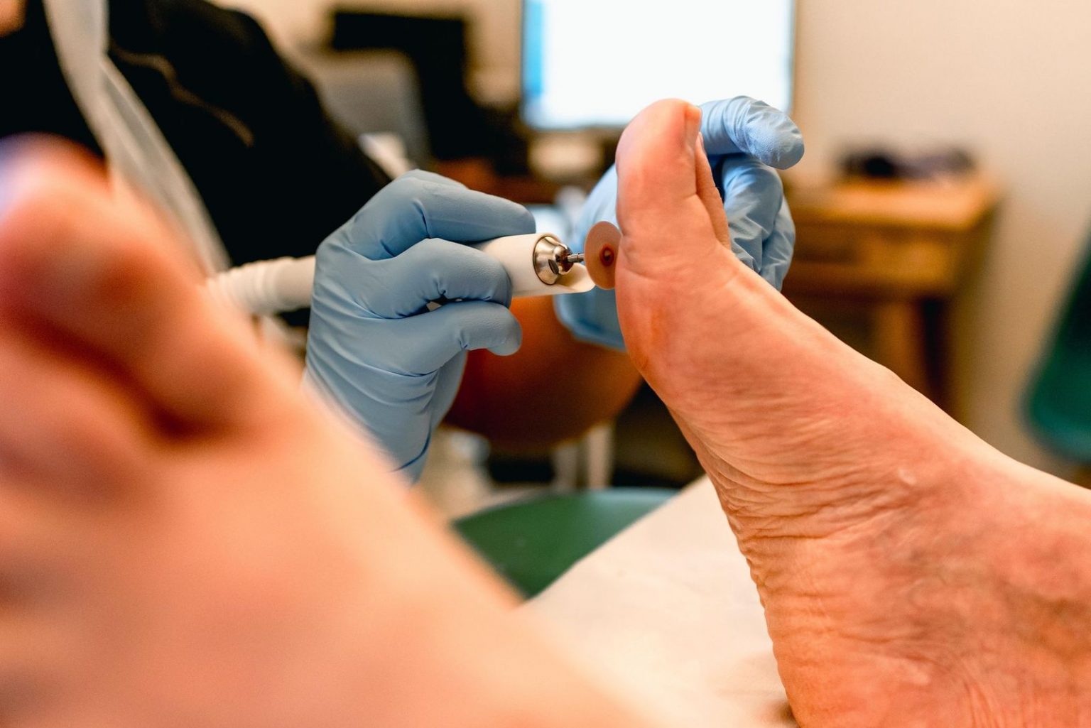 Podiatry & Chiropody, what\'s the difference? Ebrook Osteopathy