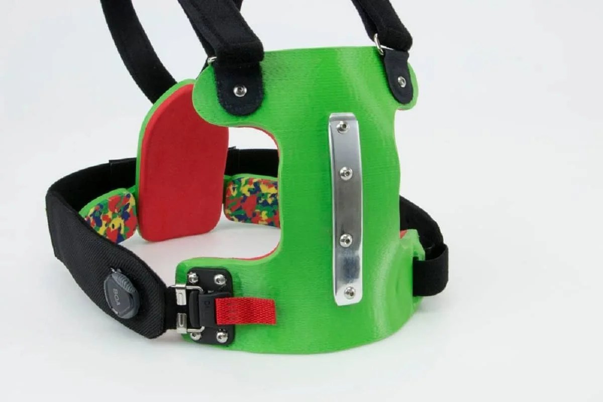 What Is Pigeon Chest? Causes, Symptoms, How to care? Ebuzz Spider