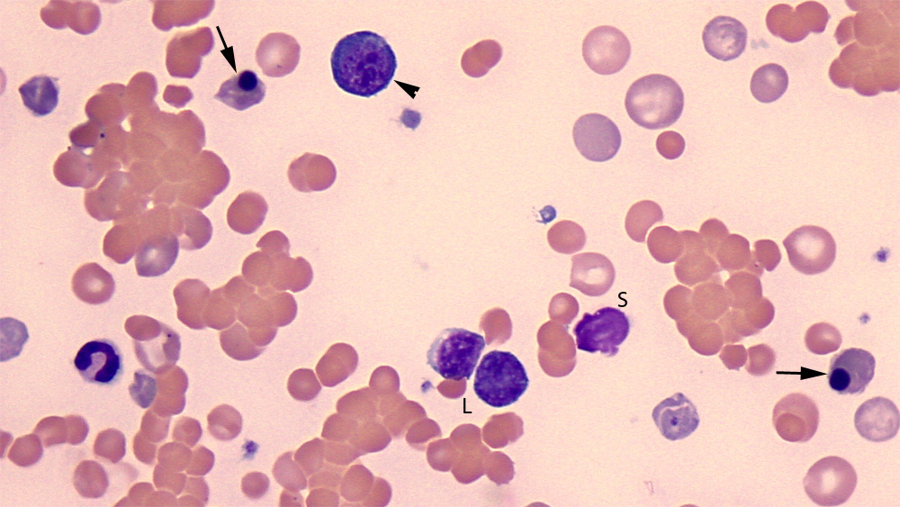 Blood from a dog with immunemediated hemolytic anemia nRBC vs lymph