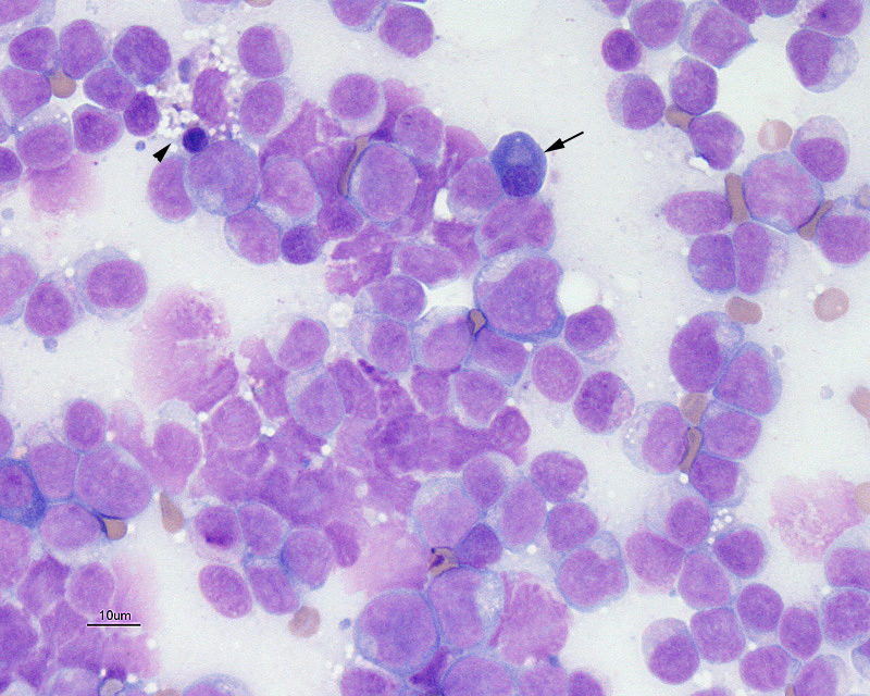 Acute myeloid leukemia in a dog (bone marrow) eClinpath