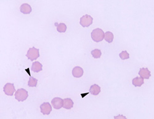 Heinz body hemolytic anemia in a cat eClinpath