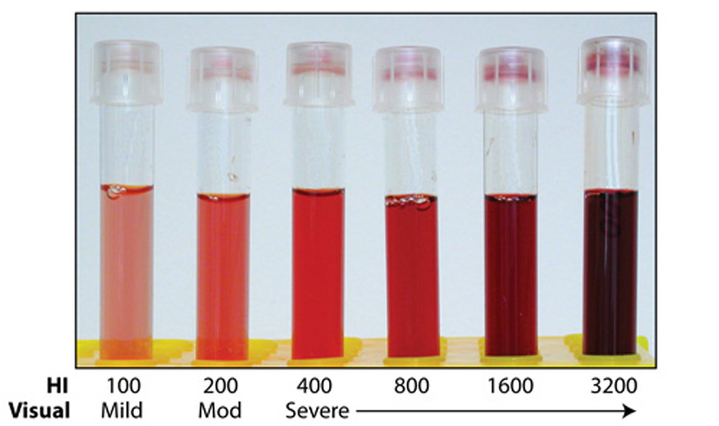 Hemolysis Index Chart