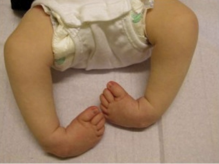 Ed Bache Paediatric & Young Adult Orthopaedic Surgeon