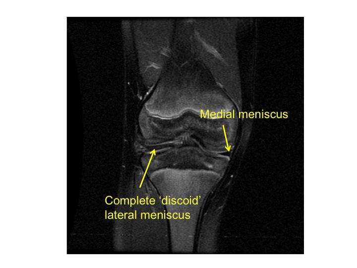 Ed Bache Paediatric & Young Adult Orthopaedic Surgeon
