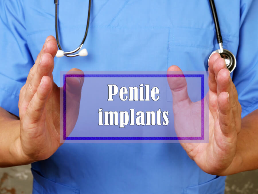 10 Facts About Penile Implants for Erectile Dysfunction (ED) Online