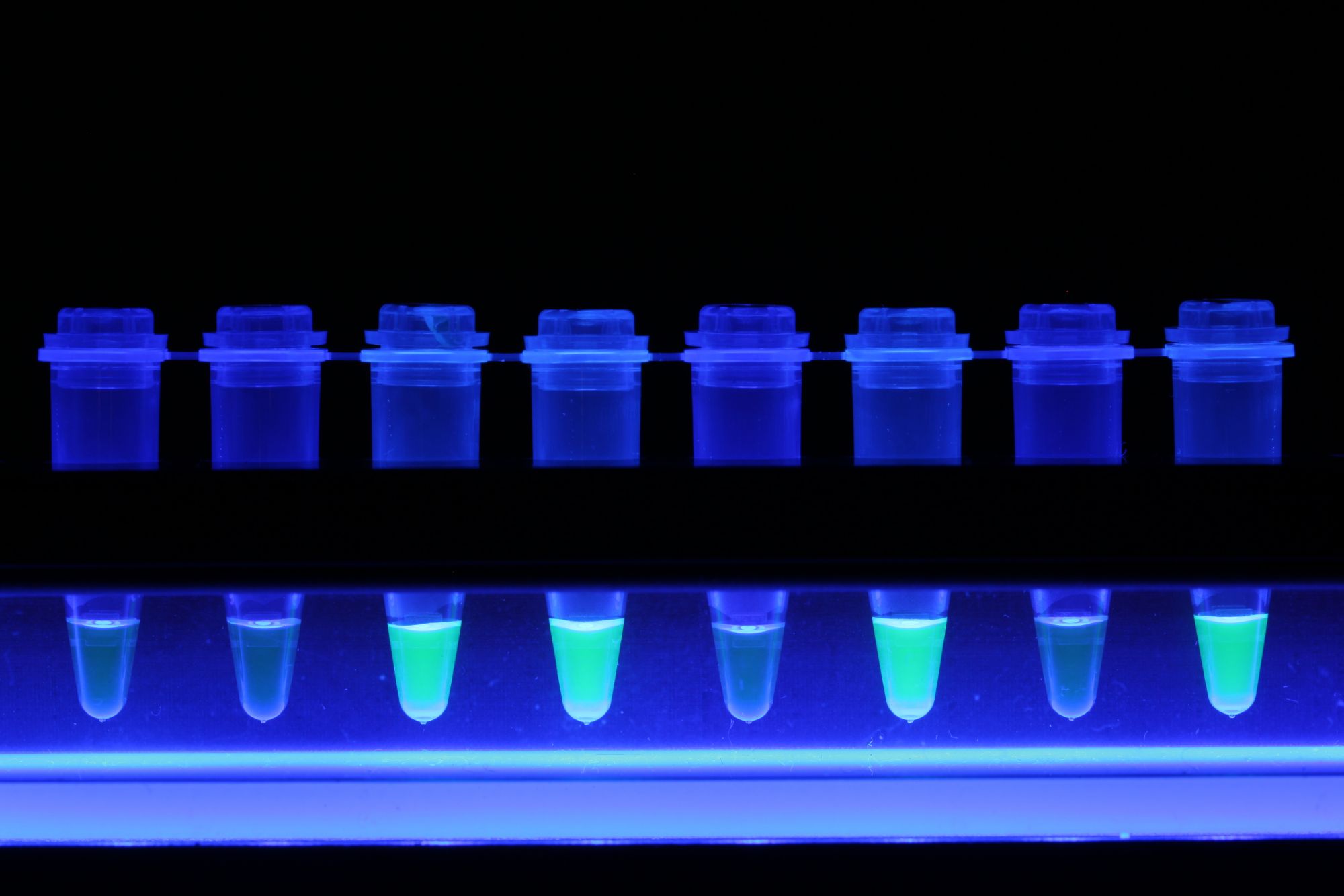 TB LAMP Application Examples Infectious diseases Our Fields EIKEN