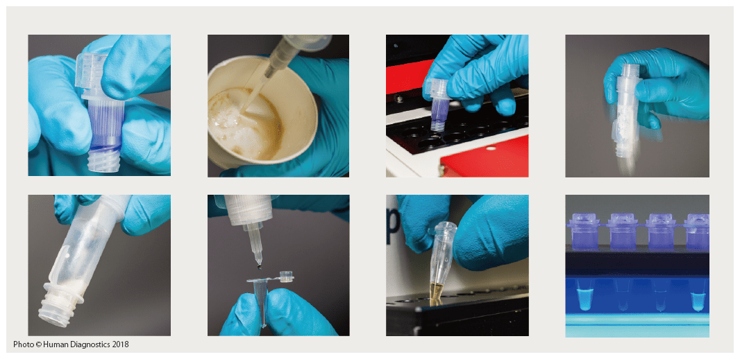 TB LAMP Operation Infectious diseases Our Fields EIKEN CHEMICAL