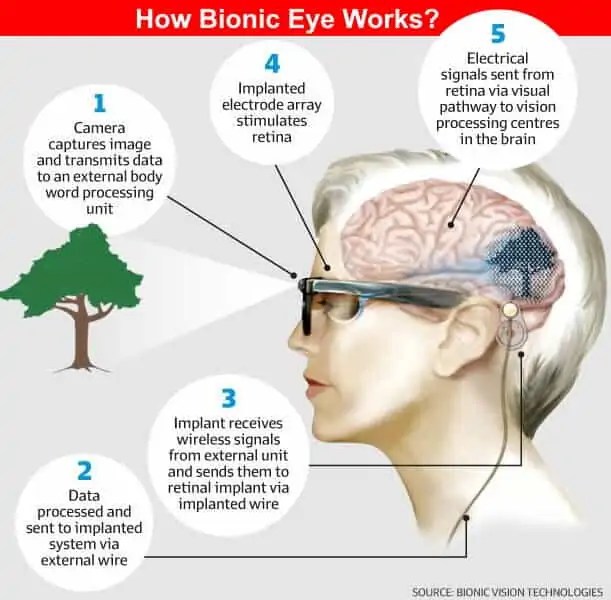 What is Bionic Eye and How Does it Work? Electrical Technology