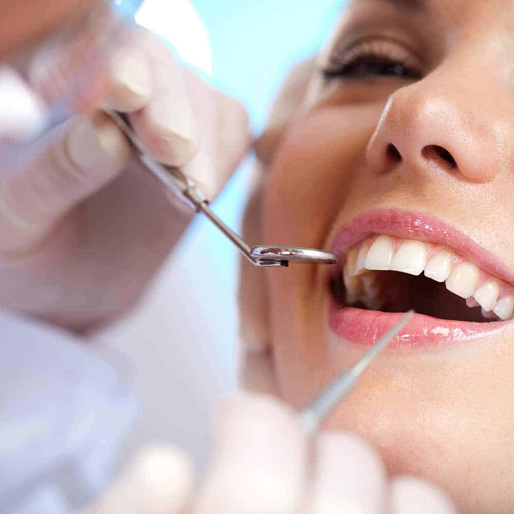 Tooth Decay Signs, Symptoms & Treatments Electric Teeth USA