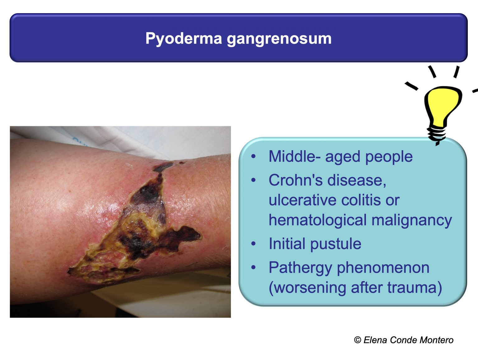 Necrosis and purple edges in leg ulcers keys to guide your diagnosis