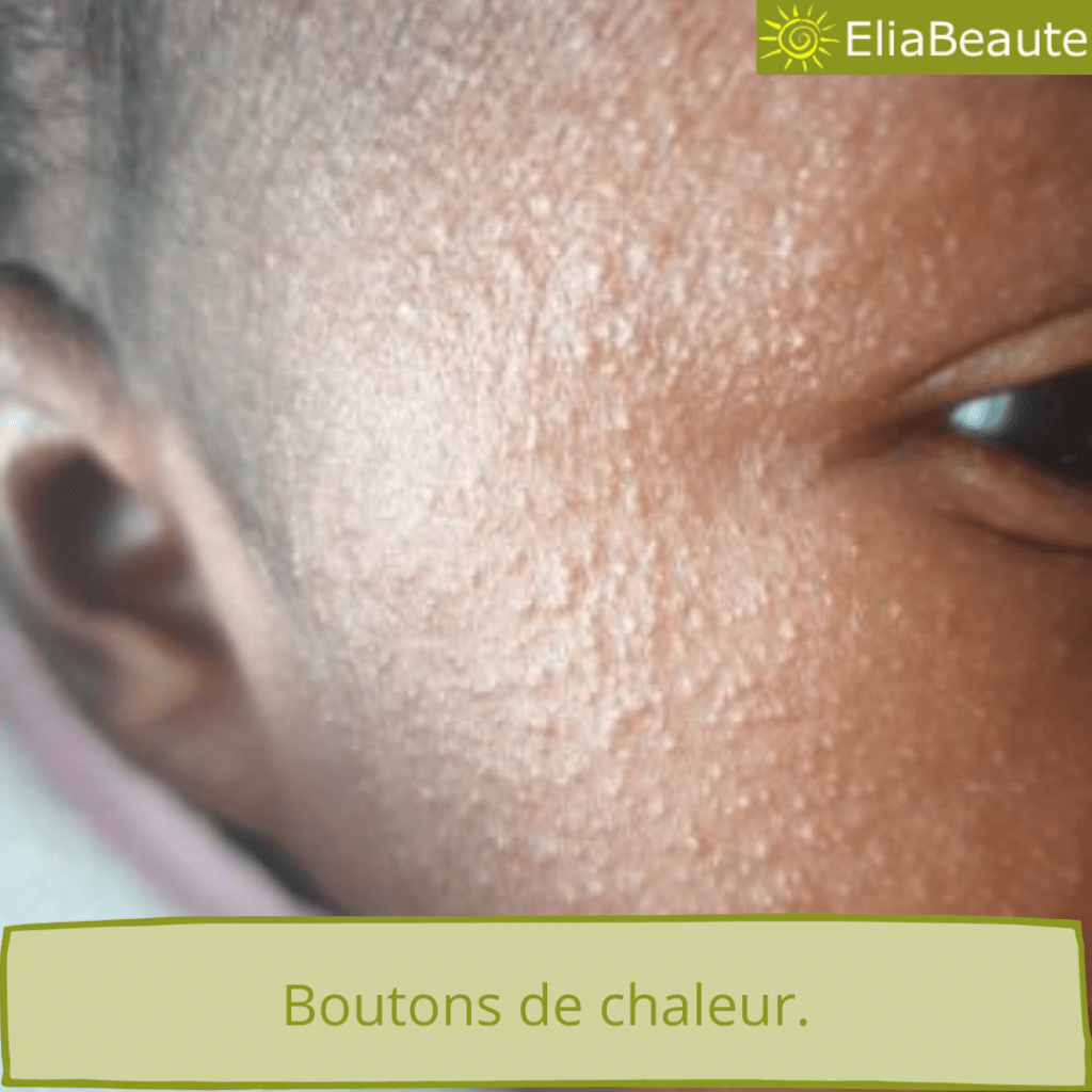 √ Télécharger l'image bebe petit bouton chaleur 752721