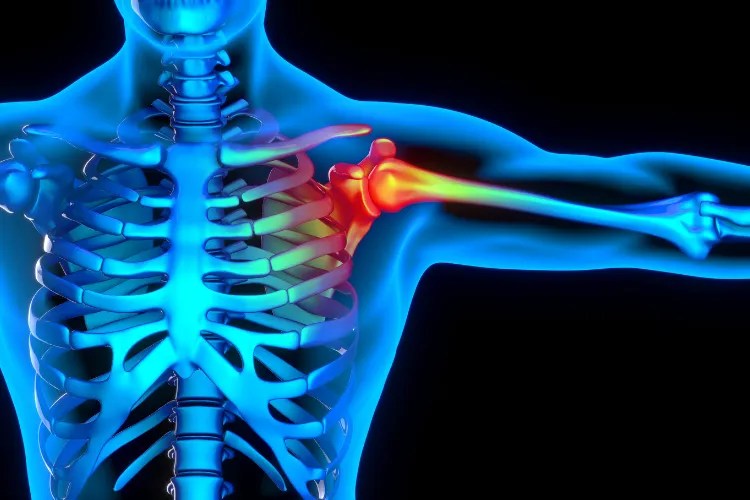 Shoulder Pain Relief in Chesterfield Chesterfield Chiropractor