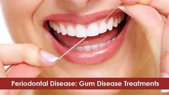Canine dentist san diego