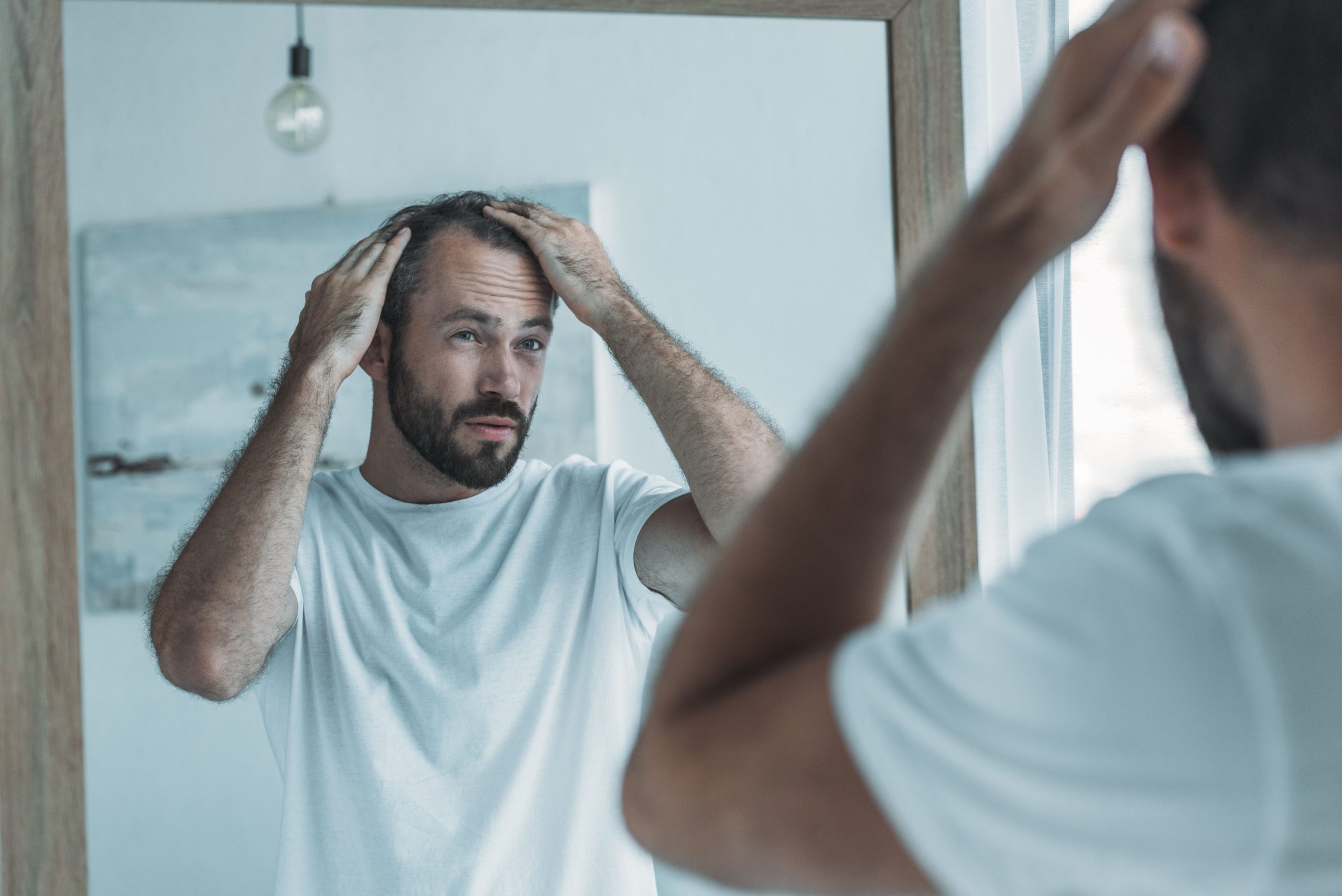 How To Avoid Hair Loss on TRT Side Effects of Testosterone Replacement