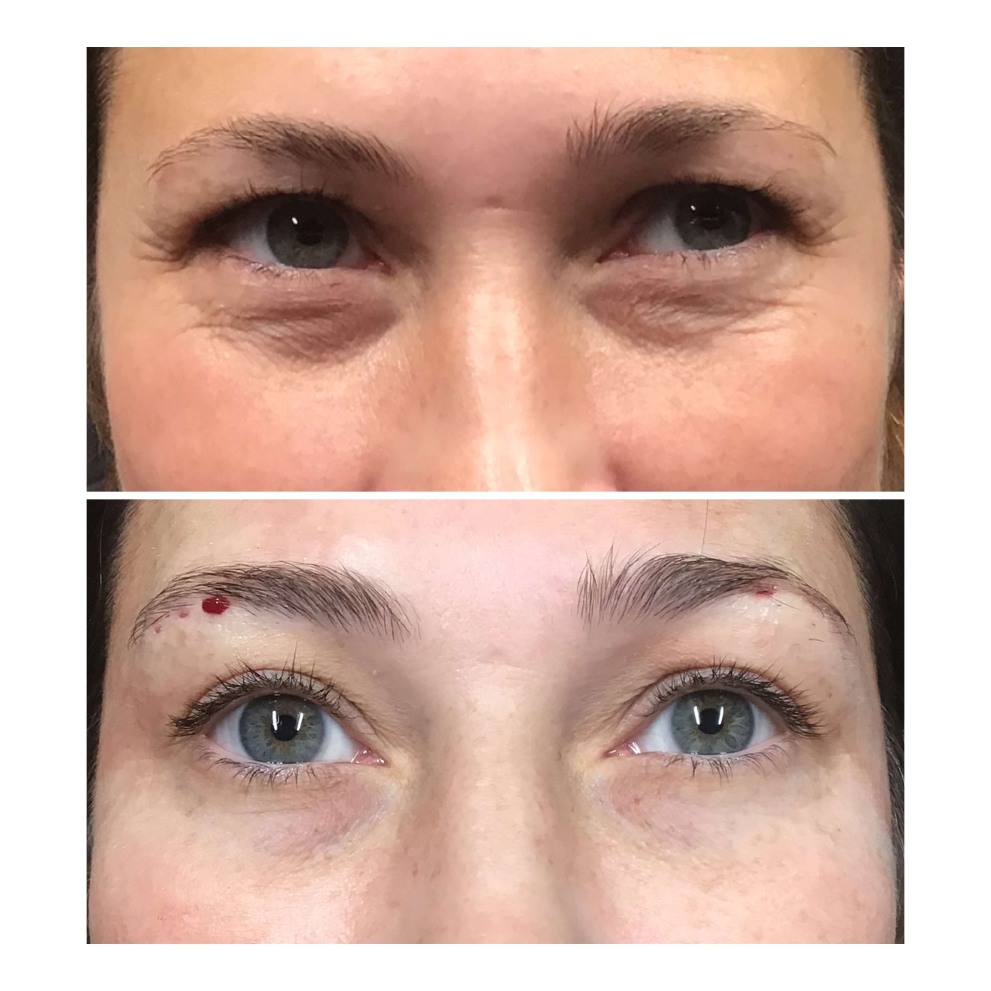 Elite Smiles Mint PDO Threads in Oklahoma City