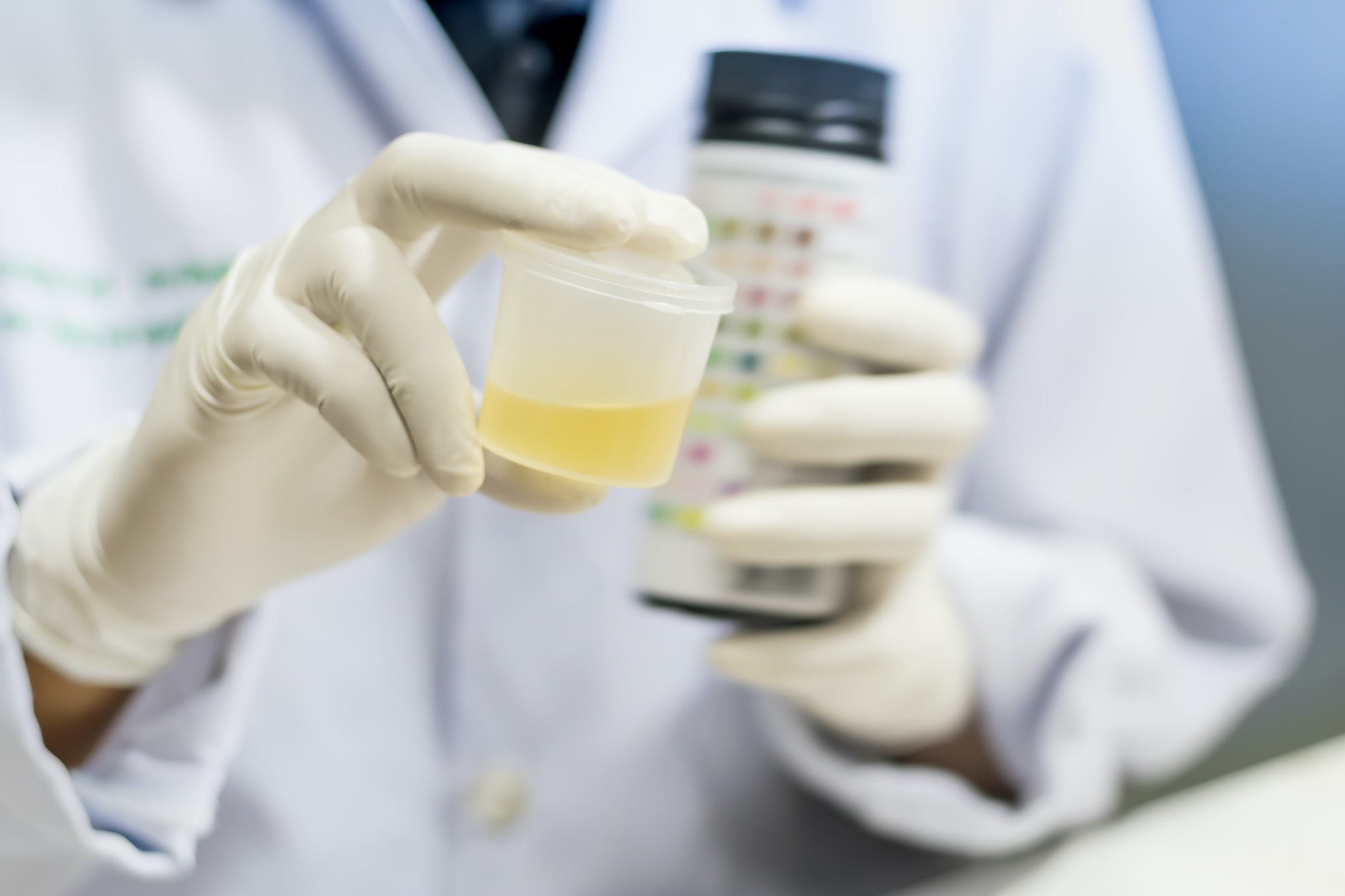 4 Top Foods to Avoid Before a Urine Drug Test ELMENS