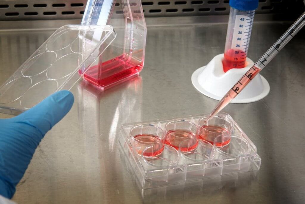 Microfluidic cell culture a beginner friendly review Elveflow