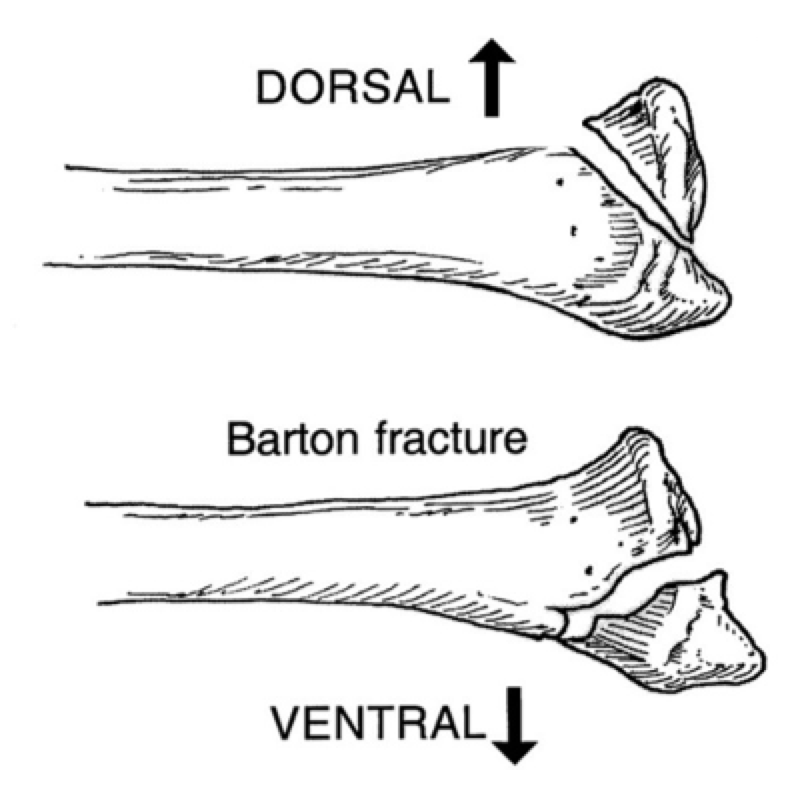 Emergency Medicine EducationWrist and Distal Forearm