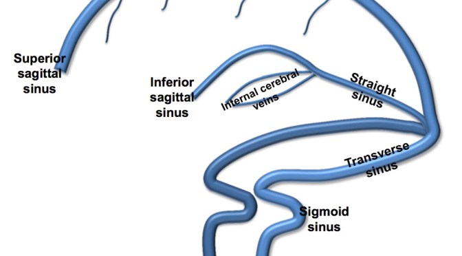 emDOCs.net – Emergency Medicine EducationCVT-Pic - emDOCs.net